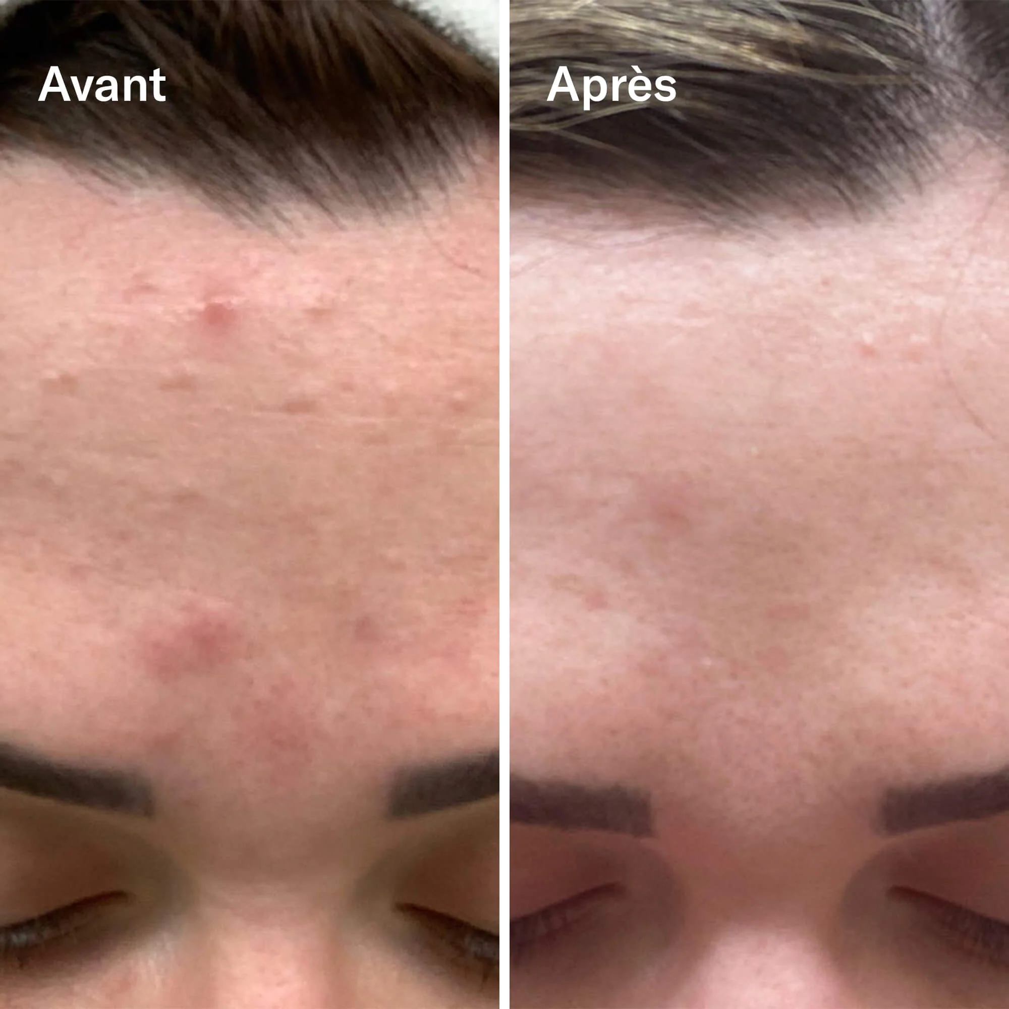 Bl+C Serum Concentrate Anti-Imperfections Black Cumin + Cajeput - Image 3
