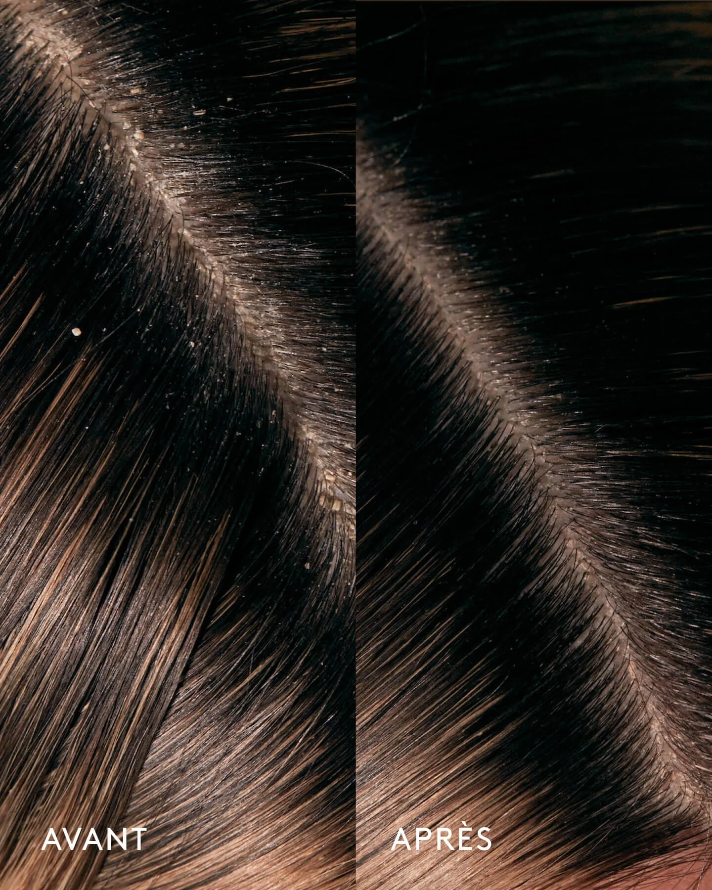 Aceite de Moska Scalp Treatment Oil - Image 4