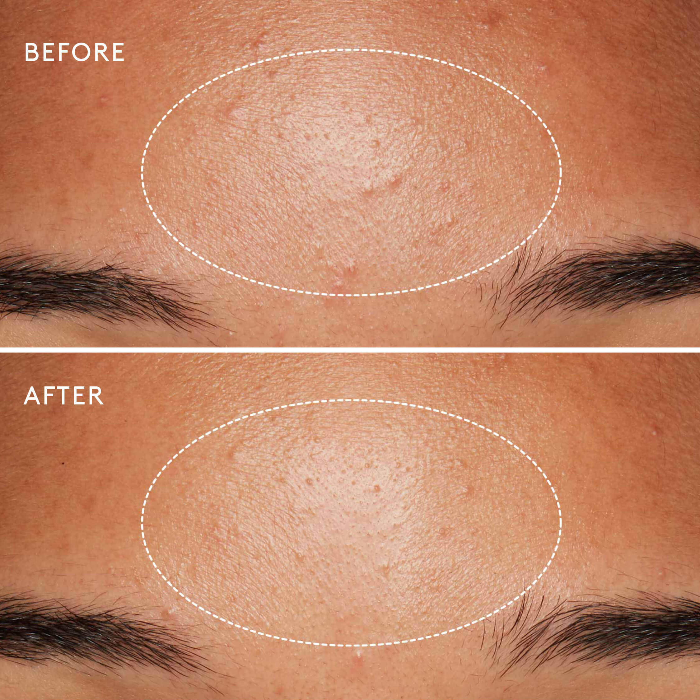 Daily Microfoliant Exfoliating Powder - Image 5