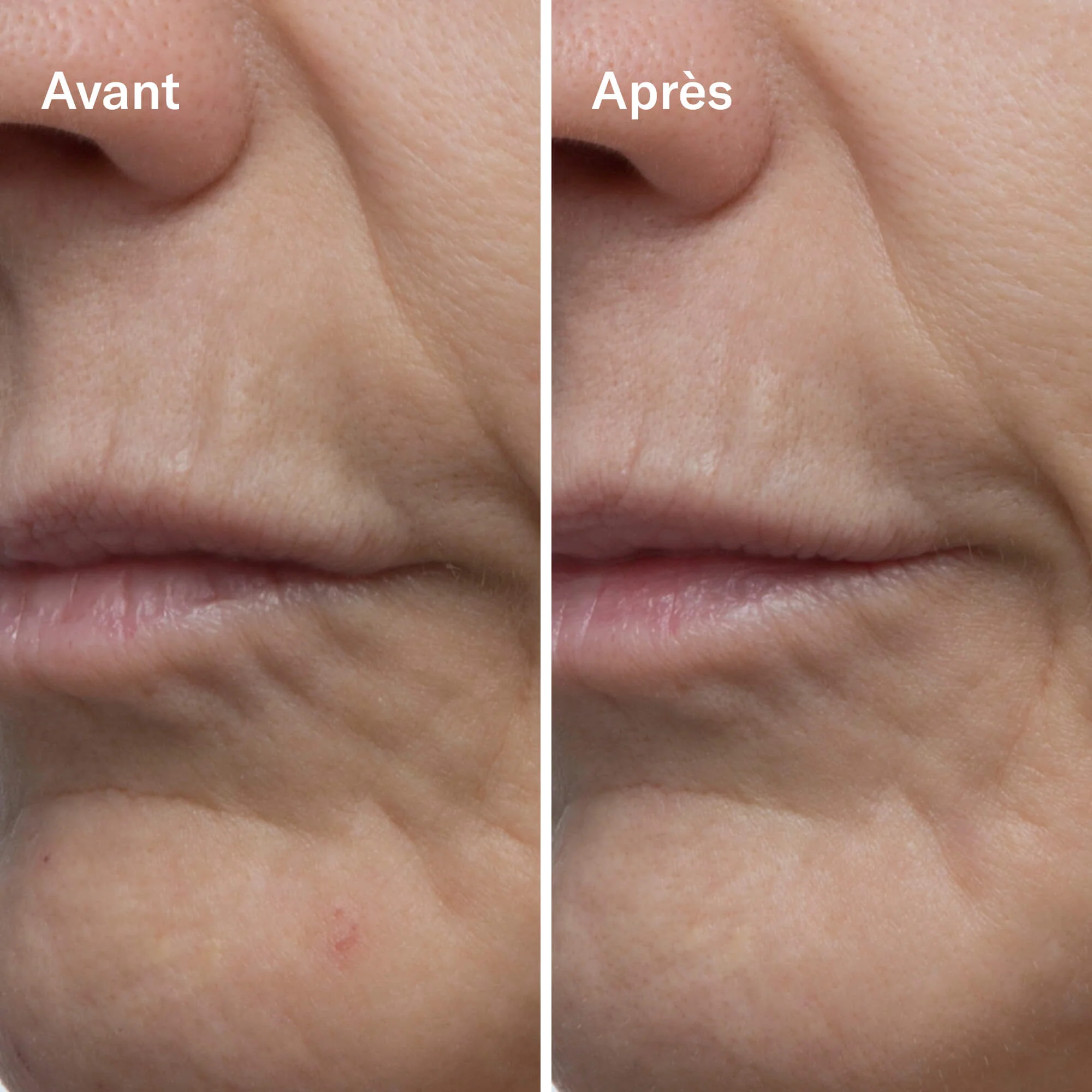 Clean-ical Renewing Serum - Image 4