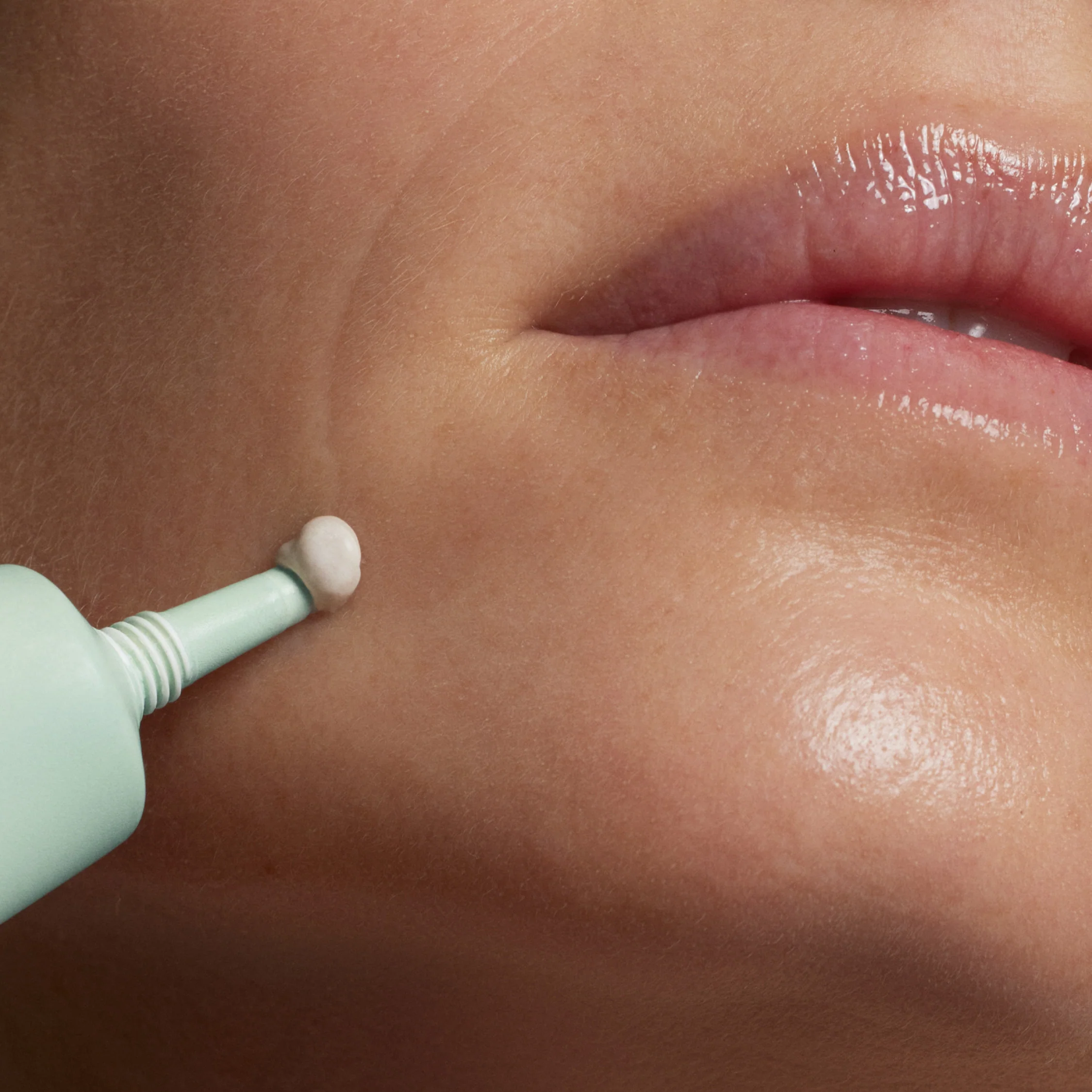 Pimple Stop Paste - Image 3