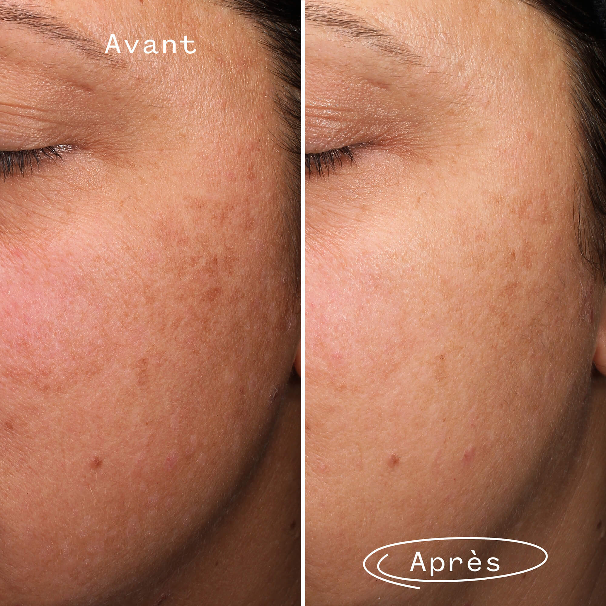Fade Forward Anti-Spot Serum - Image 4