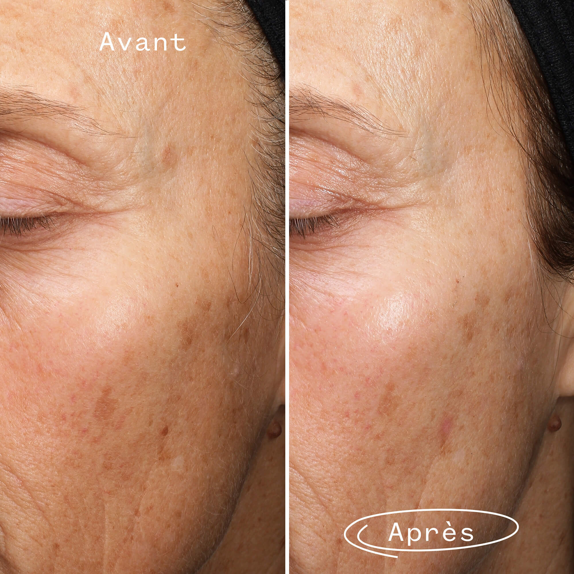 Fade Forward Anti-Spot Serum - Image 5