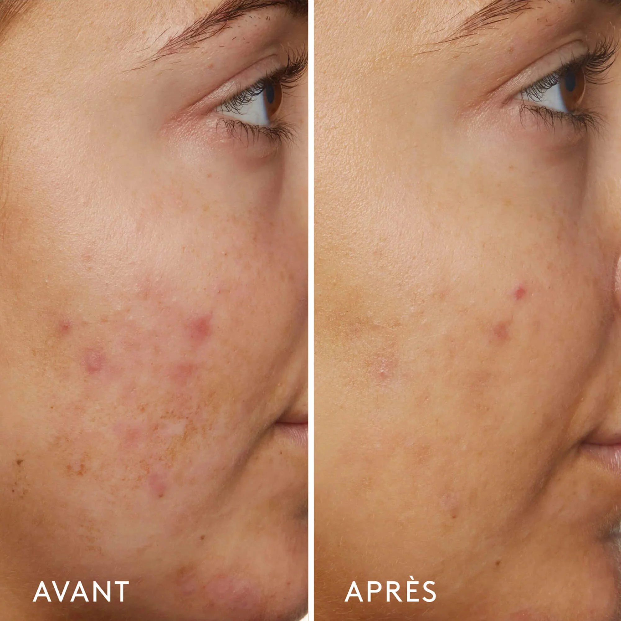 B3 Nice 10% Niacinamide Rebalancing Serum - Image 3