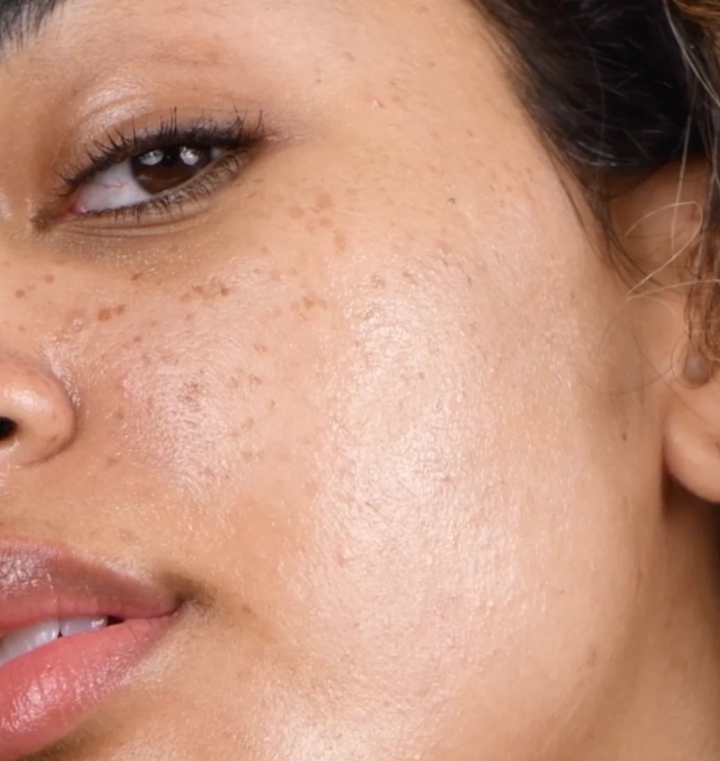 Good Genes All in One Lactic Acid Treatment Serum - Image 6