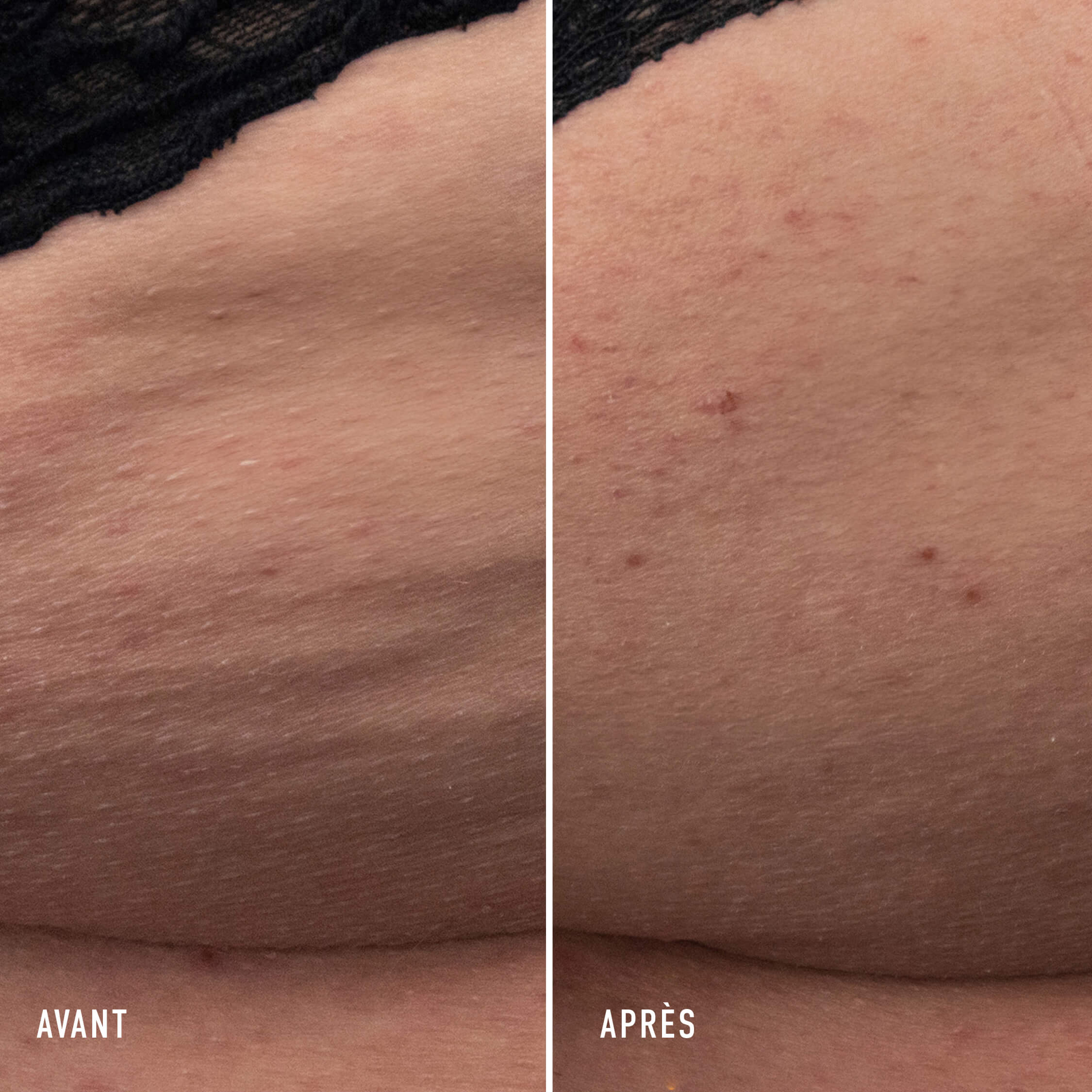 The Body Cream Anti-Aging Body Cream - Image 3