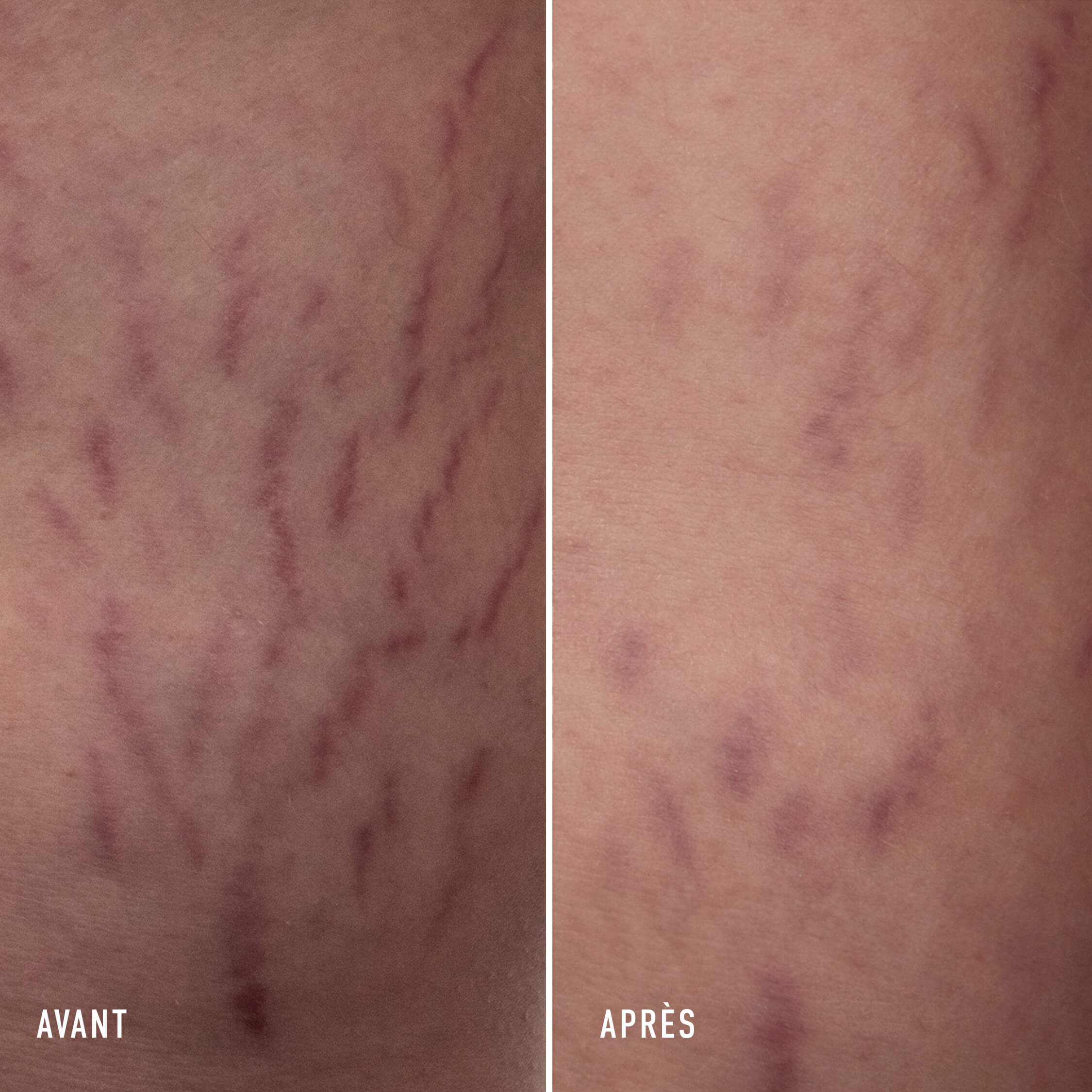 The Body Cream Anti-Aging Body Cream - Image 4